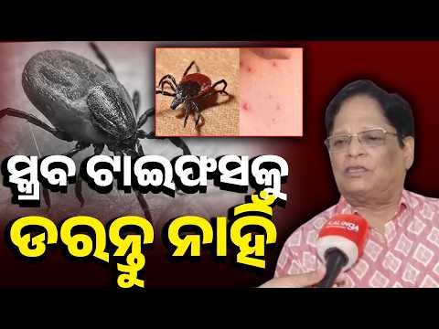 ପାଳଲହଡ଼ାରେ ସ୍କ୍ରବ ଟାଇଫସ ବ୍ୟାପିବା ନେଇ ବଡ଼ କଥା କହିଲେ ସିଡିଏମଓ #knewsodisha