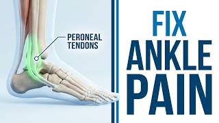 Peroneal Tendonitis Pain Relief: 3 Must Do Exercises