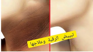 احسن كريم لتبييض الرقبة