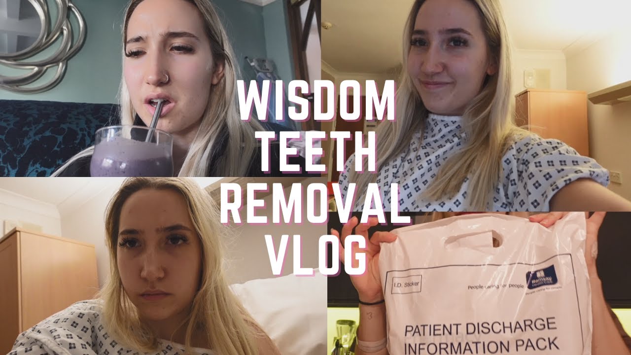 Wisdom Teeth Removal Vlog | Advice, Going Under and Recovery - YouTube