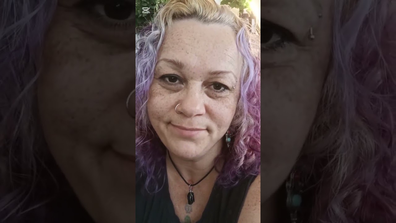 Camuflaje de Canas Profesional | Método Arquitectónico VAM – Caso Real