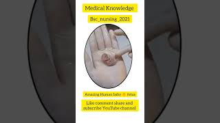 #amazing  Human baby #fetus 🐥 || #short #baby #babygirl #love #babyboy #newborn #kids #cute #family