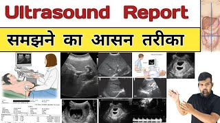 Ultrasound Report | Sonography | USG | Gynacology | Doctor | Nursing | Hospital | Treatment | Bhms screenshot 1