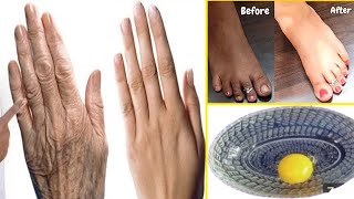 Absolute Best Remedy for Dry and Wrinkled Hands and Feet.