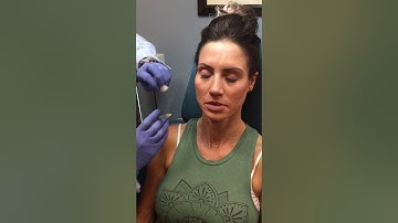 Dr. Raval demonstrates a Volbella injection