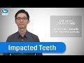 All about Impacted teeth