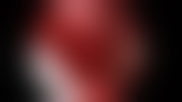 Visualization of Cranial Nerves Using High-Definition Fiber Tractography