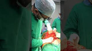 Tummy Tuck Surgery immediate result shorts