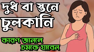 মেয়েদের স্তনে চুলকানি কেন হয়? | কারণ, প্রতিরোধ ও পরামর্শ | স্তনের সমস্যা সমাধান || Breast problem
