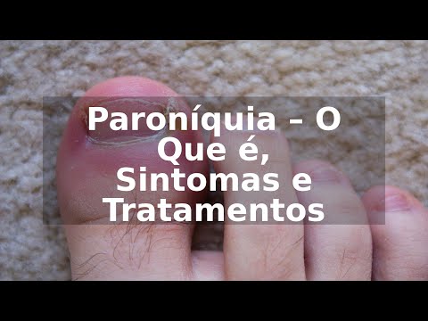 Paroníquia – O Que é, Sintomas e Tratamentos