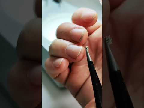 انظر ماذا يوجد في الاظافر تحت الميكروسكوب