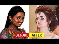 Plastic Surgery से पहले और बाद की 10 बॉलीवुड अभिनेत्रियाँ | 10 Actresses Before and After Surgery