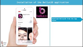 How To Scan With Bellus 3D Iphone X Or Ipad Pro
