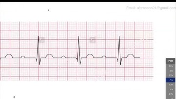 Welcome Tutorial: Primary