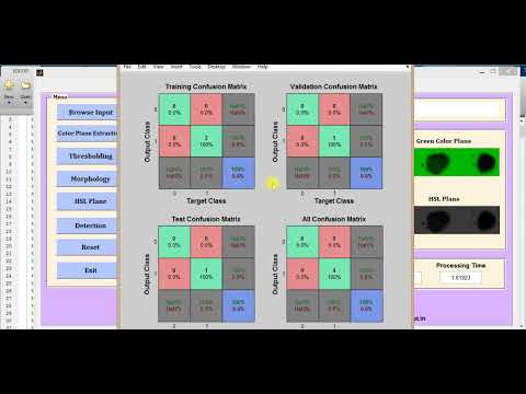 Matlab Code For Blood Group Type Detection Using Neural Network | Matlab Project With Source Code