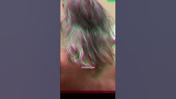 Dr Pimple Popper Performs Magic & Makes It Disappear! #shorts