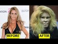 25 celebrities before and after plastic surgery
