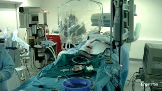 Показательная операция по транскатетерной имплантации аортального клапана