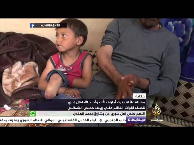 معاناة عائلة سورية بترت اطراف معيلها جراء قصف على ريف حمص الشمالي