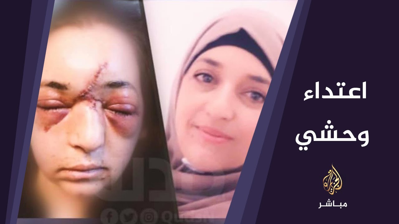 قوات الاحتلال تعتدي على أم فلسطينية أثناء محاولتها تخليص طفلها من الاعتقال