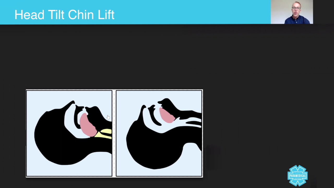 Head Tilt Chin Lift Australian Paramedical College YouTube