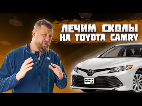 Видео: КАК ЗАКАПАТЬ СКОЛЫ НА АВТОМОБИЛЕ?