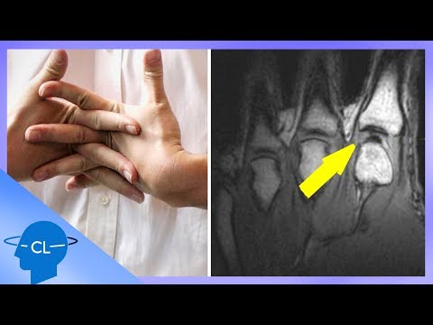 Video: Cum Să Vă Coaceți Degetele