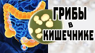 КАК ИЗБАВИТЬСЯ ОТ ГРИБКА КИШЕЧНИКА \\  ПРОФИЛАКТИКА ГРИБКА КИШЕЧНИКА\\  СОВЕТЫ ВРАЧА