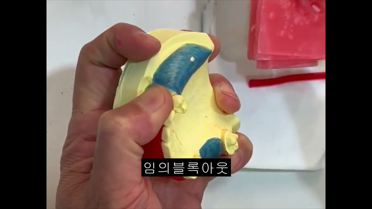 6  상악 형상, 임의 블록아웃4분 6초