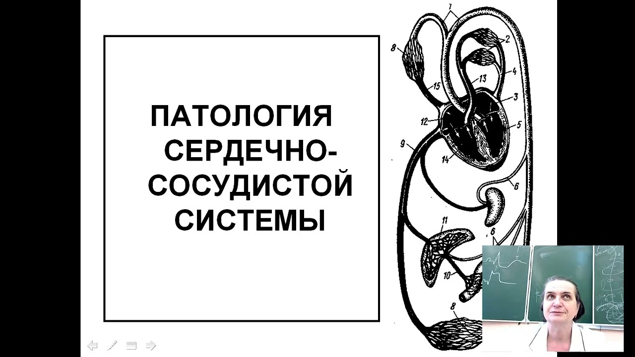 Патология системы кровообращения. Prof. Maksimovich N.Ye.