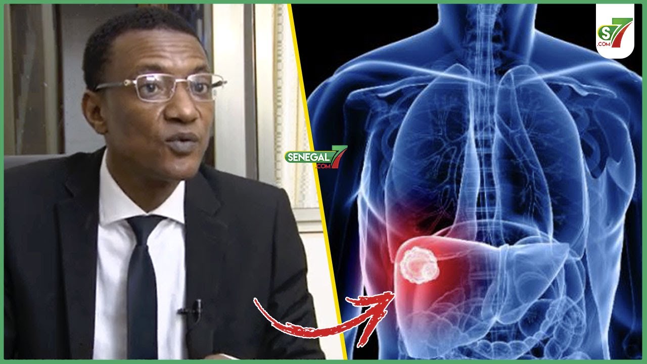 Cette solution qui va guérir définitivement l'hépatite B : Dr Abdoulaye Daillo livre les secrets