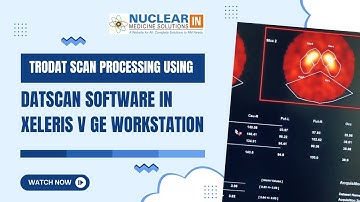 TRODAT Scan Processing Tutorial | DaTscan Analysis on Xeleris Workstation | GE NM Workflow Guide