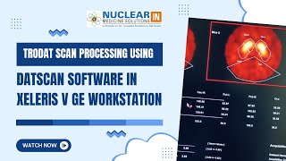 Trodat Scan Processing Tutorial Datscan Ysis On Xeleris Workstation Ge Nm Workflow Guide
