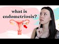 What Is Endometriosis? | Symptoms, Diagnosis, Treatment