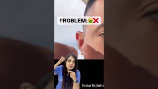 How to correct Bat ears #drnalliramya #telugudoctor #ent #doctor #vizag #batears #otoplasty #ear
