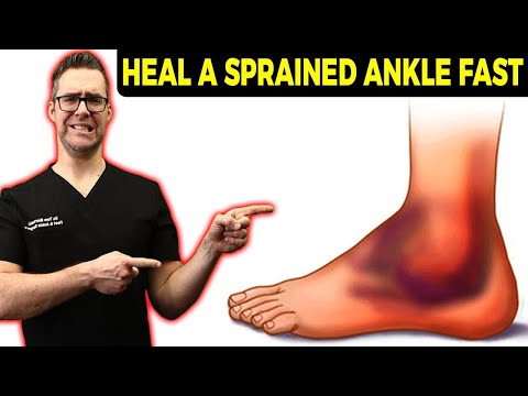 Ankle Sprain Treatment [BEST Home Ankle Rehabilitation 2024]