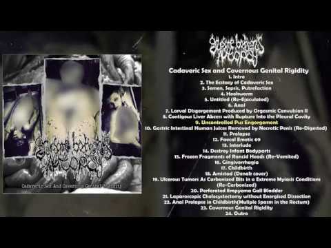 Cadaveric Sex And Cavernous Genital Rigidity artwork