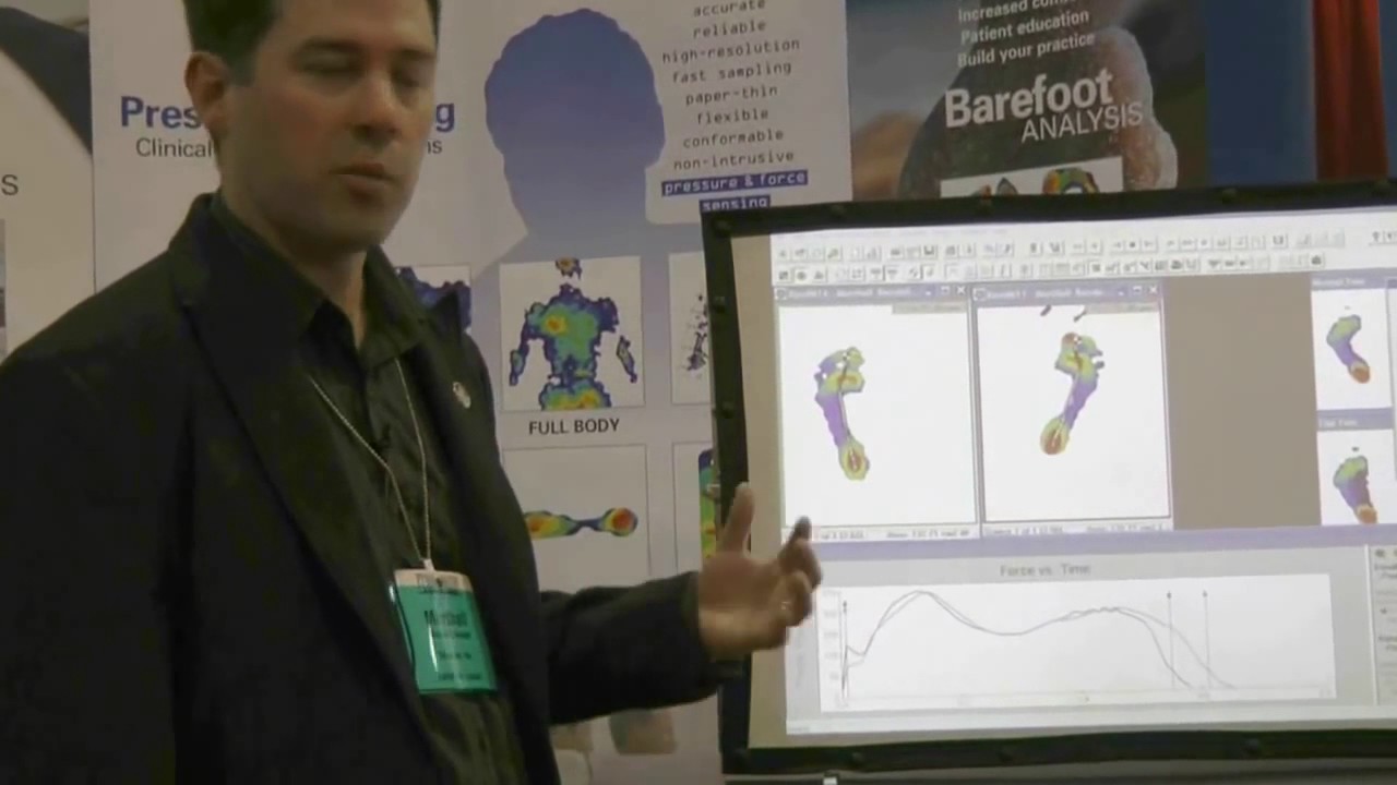 MatScan™ Barefoot Screening Device