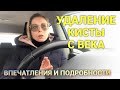 Удаление кисты с века. Рассказ во всех подробностях. Просто дневник Константиновой.