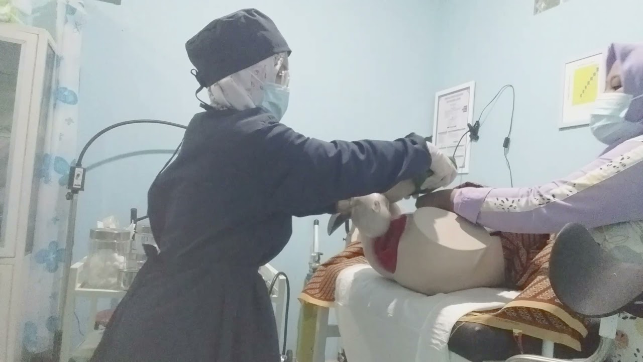 Pertolongan Persalinan Sungsang dengan Teknik Bracht