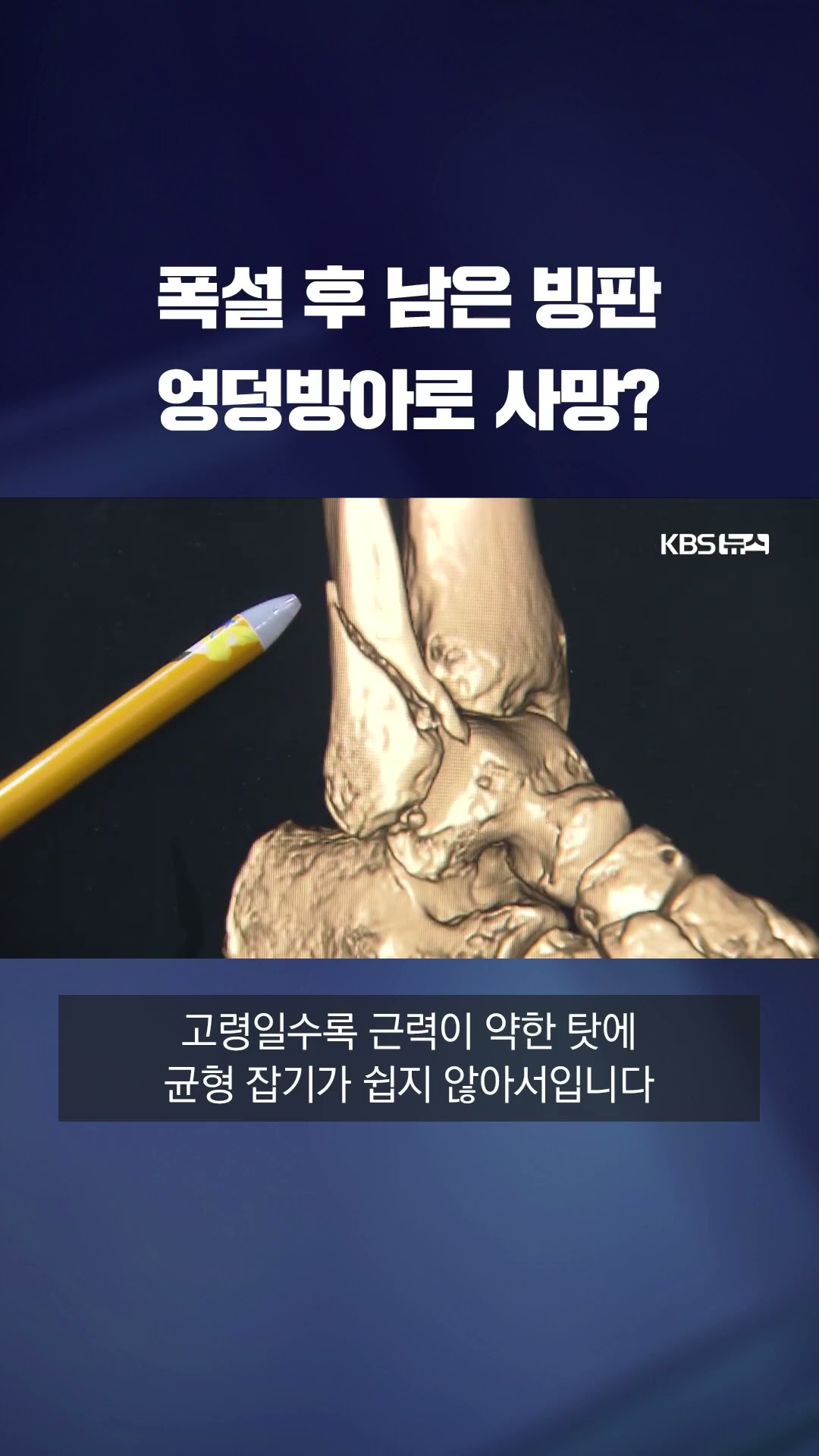 빙판길 낙상 잇따라…노인 고관절 골절 사망 위험 최대 40% #shorts / KBS