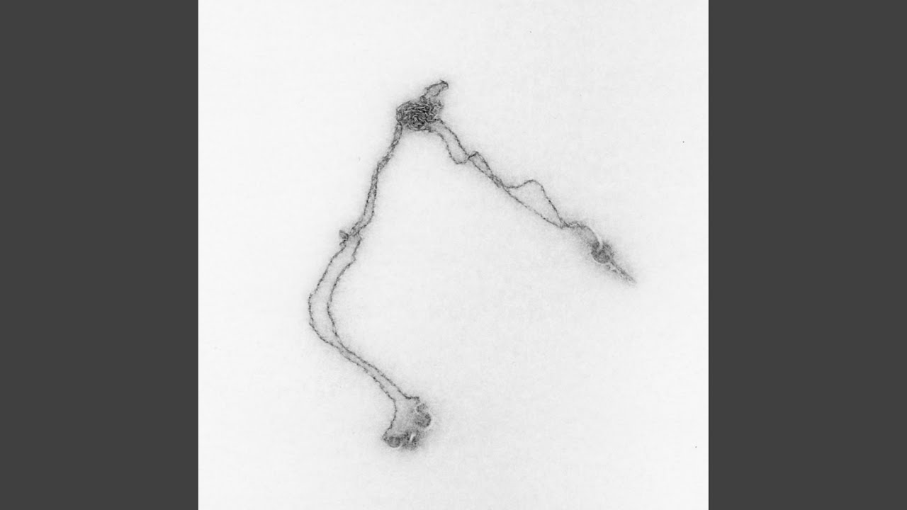 Watch Toxoplasma on YouTube Watch Toxoplasma on YouTube