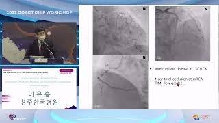 Auditorium 2022 Coact Chip Workshop 1-5 Operators Mistakes Dealing Wire 이유홍