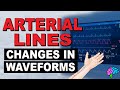 Common Changes in Arterial Line Waveforms