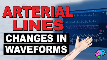 Common Changes in Arterial Line Waveforms