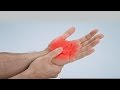 What can cause pain in the palm of the hands