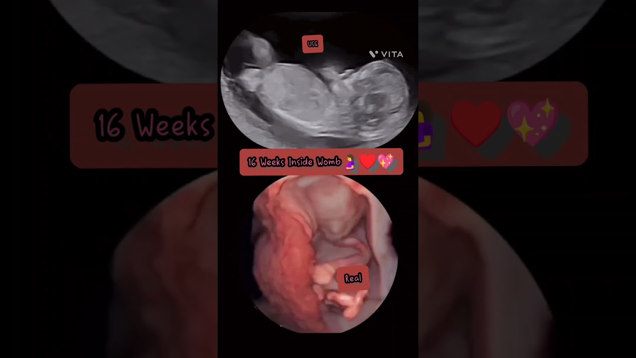 Baby Inside the womb during ultrasound scan🤰👶♥️ 