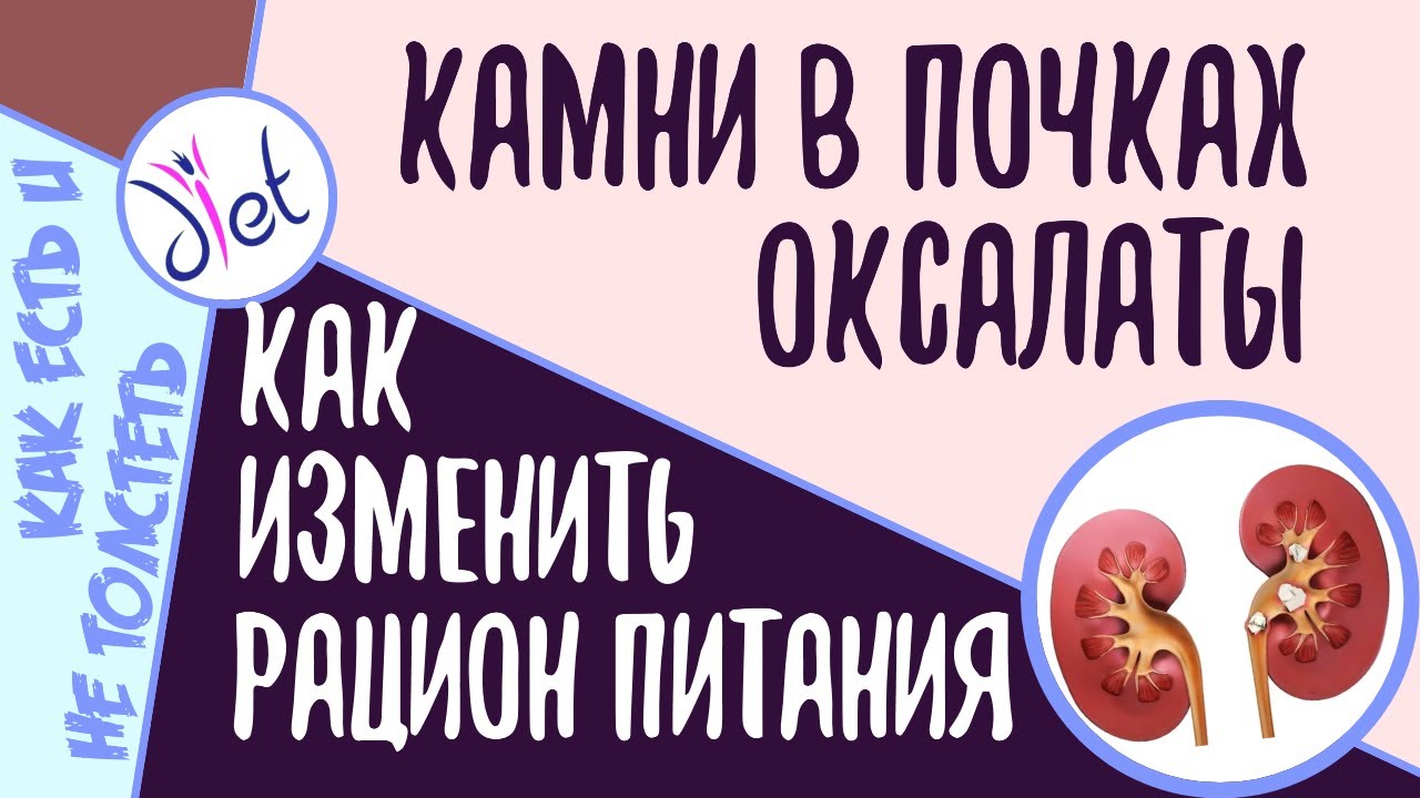 диета при оксалатных камнях в почках