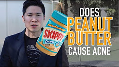 Does Peanut Butter Cause Acne?