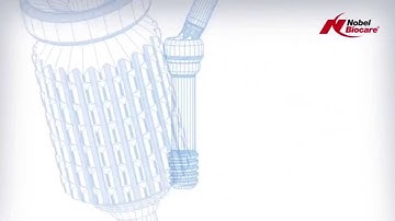 Angulated Screw Channel (ASC) Abutment